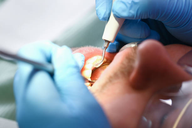 Best 24-Hour Emergency Dentist in Marietta, OK
