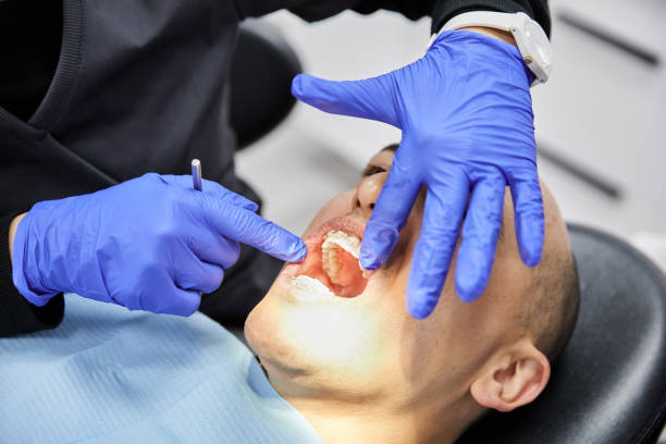 Best Emergency Root Canal Treatment in Marietta, OK