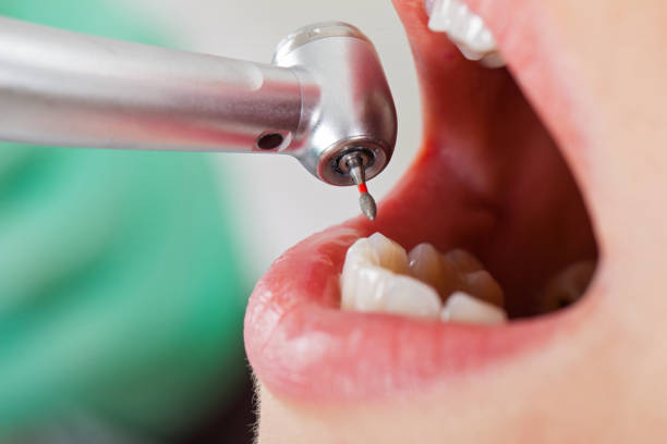 Best Orthodontic Emergency Dentist in Marietta, OK